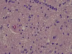 High power microscopy