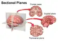 Sectional planes of the brain