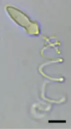 A light micrograph of a bullet-shaped cell with a large spiral filament (the extruded nematocyst).