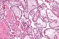 Micrograph showing chorionic villi. Intermediate magnification. H&E stain.