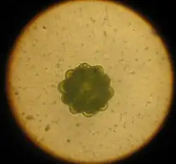 Coenobium of Coelastrum sp.
