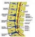 Lumbar disc lesions, classification