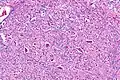 Micrograph showing the hypoglossal nucleus. H&E-LFB stain.