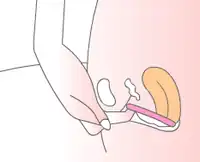 Hooking a finger under the rim of a ring-shaped cup to remove it; the finger can also be hooked over the rim, or the rim can be pinched.